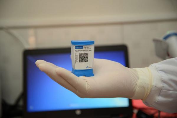 CTA em Santarém passa a contar com máquina de carga viral que dá resultado em horas CTA em Santarém passa a contar com máquina de carga viral que dá resultado em horas