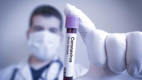 Coronavírus: número de casos confirmados sobe para 34 no Brasil Coronavírus: número de casos confirmados sobe para 34 no Brasil
