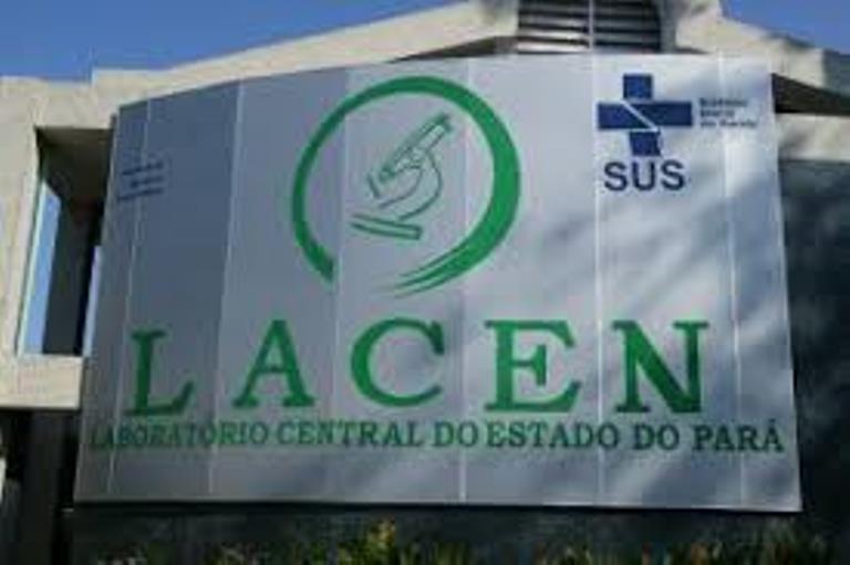 Sespa confirma segundo caso de Covid-19, no Pará Sespa confirma segundo caso de Covid-19, no Pará