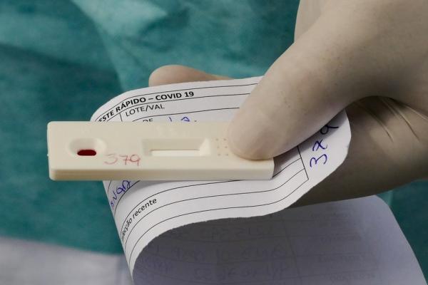 Amazonas volta a registrar aumento em novos casos de Covid-19: 1.421 nesta terça (2) Amazonas volta a registrar aumento em novos casos de Covid-19: 1.421 nesta terça (2)
