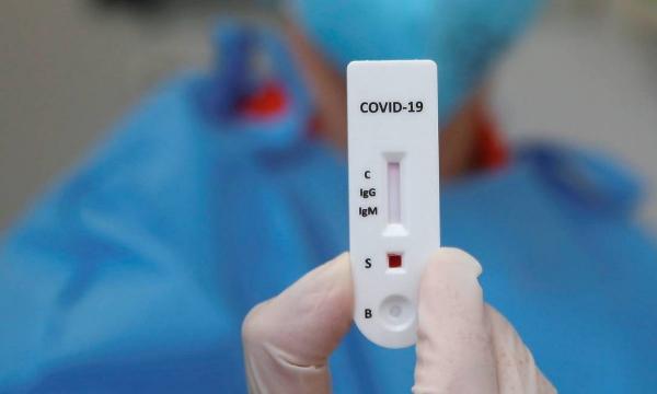 1.219 novos casos de Covid-19 no Amazonas; cinco pessoas morreram nas últimas 24h 1.219 novos casos de Covid-19 no Amazonas; cinco pessoas morreram nas últimas 24h