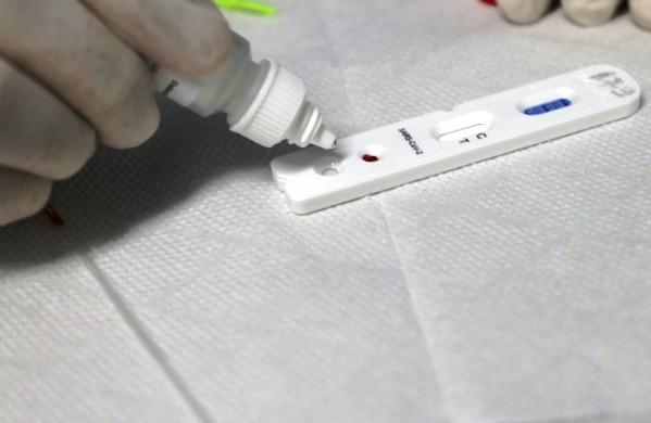 2.740 infectados por Covid-19 no AM e seis mortes nas últimas 24h, nesta terça (7) 2.740 infectados por Covid-19 no AM e seis mortes nas últimas 24h, nesta terça (7)