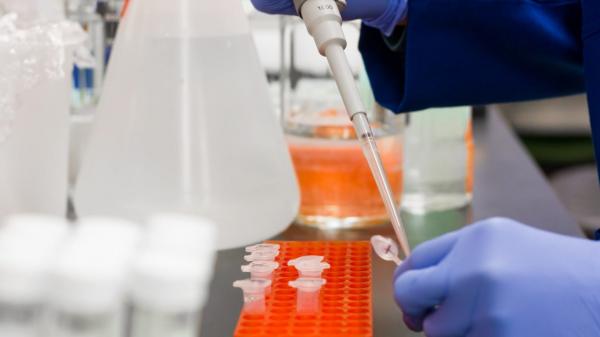 Israel detecta primeiro caso de 'flurona', dupla infecção por Covid e gripe Israel detecta primeiro caso de 'flurona', dupla infecção por Covid e gripe